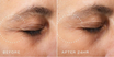 Crystal Retinal Ceramide Eye 3